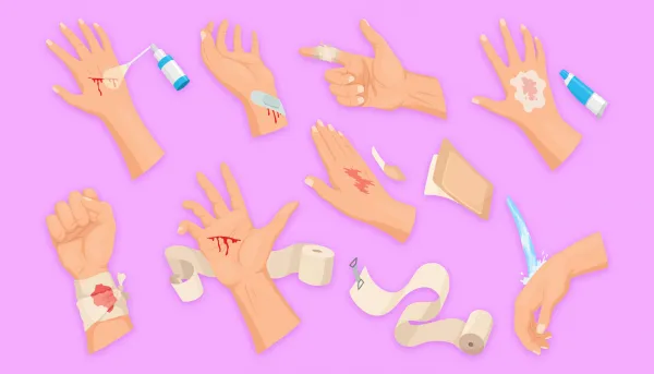 Verschiedene Wundversorgungsarten