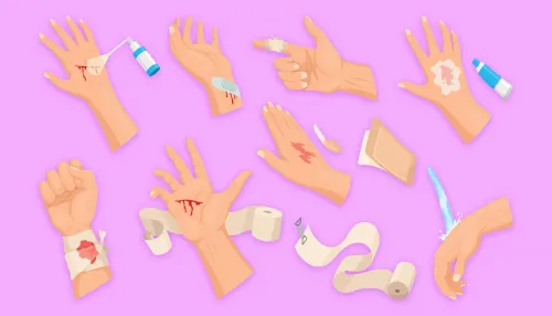 Verschiedene Wundversorgungsarten