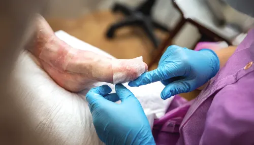 Offen Wunde am Fuß, die von einem Arzt in einer Klinik verbunden wird