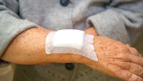 Nahaufnahme eines operierten und verbundenen Handgelenkes einer älteren Frau.